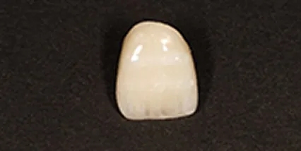 セレック ジルコニアクラウン