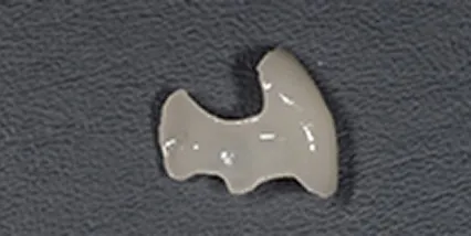 セレックインレー