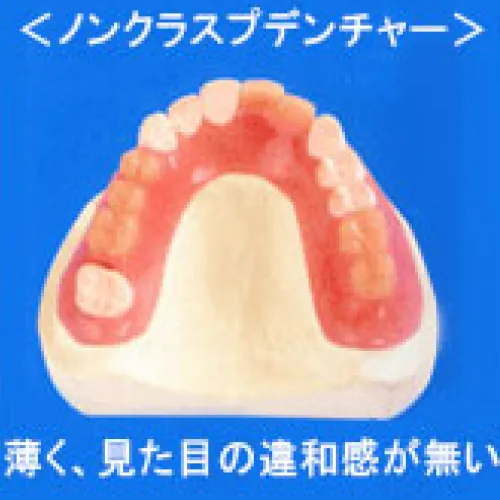 ノンクラスプデンチャー