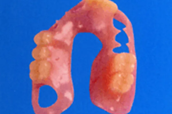 お口の中に固定