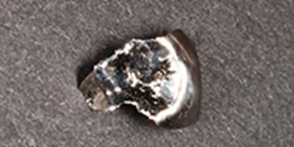 銀歯（保険適応）