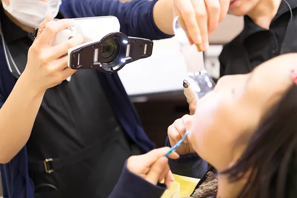 口腔内写真撮影