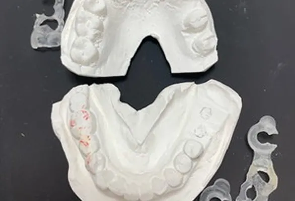 インプラント治療の流れ